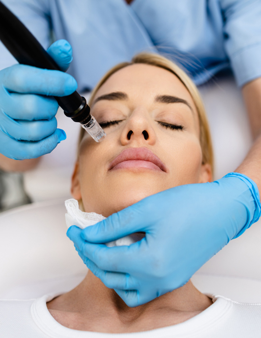 أجهزة الراديو فريكونسي مايكرونيدلنغ